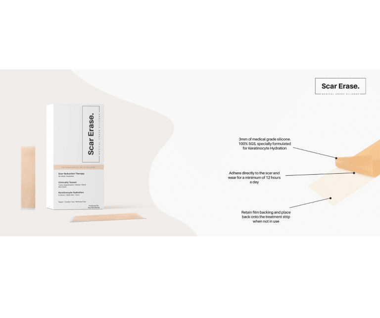 Innovative Scar Reduction Introduced by UK Sisters