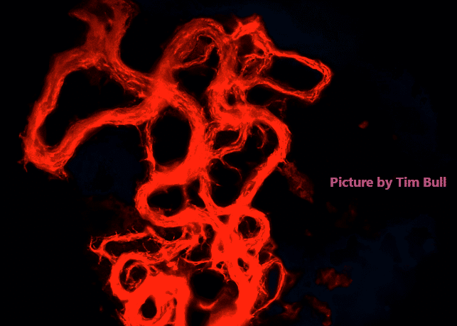 Tuberculosis Takes an Unexpected Turn: Innovative Peptides Revolutionize Culture Diagnosis